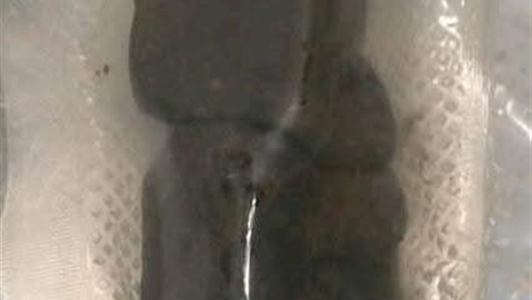 الحياة اليوم